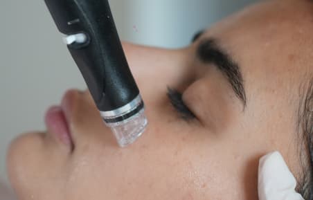 beauty-hydrafacial-thumb
